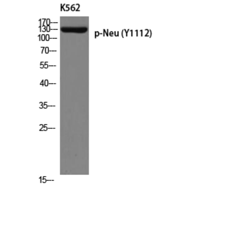 Western Blot - Anti-HER2 (phospho Tyr1112) Antibody (A8039) - Antibodies.com