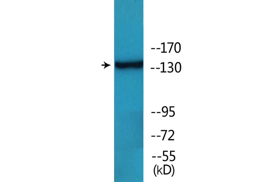 Western Blot - Anti-HER2 (phospho Tyr1112) Antibody (P12-1114) - Antibodies.com