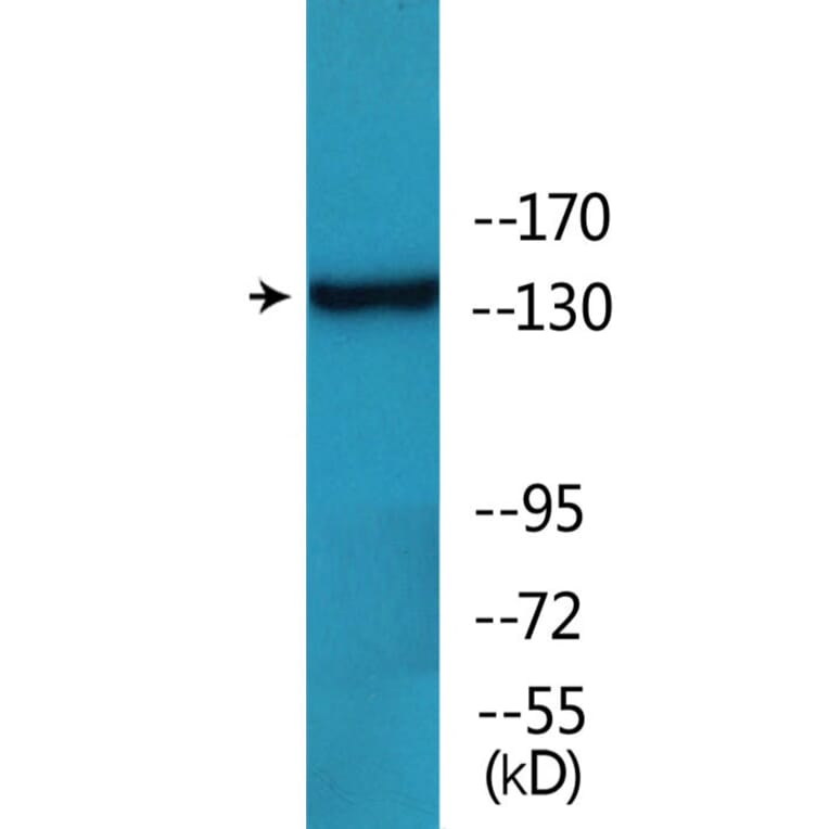 Western Blot - Anti-HER2 (phospho Tyr1112) Antibody (P12-1114) - Antibodies.com