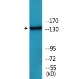 Western Blot - Anti-HER2 (phospho Tyr1112) Antibody (P12-1114) - Antibodies.com