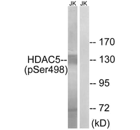 Western Blot - Anti-HDAC5 (phospho Ser498) Antibody (A7101) - Antibodies.com