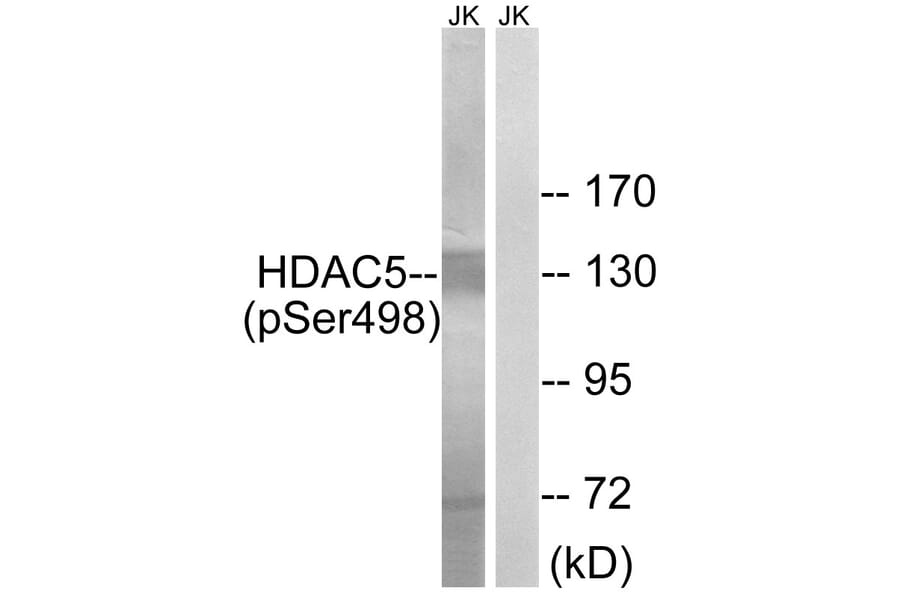 Western Blot - Anti-HDAC5 (phospho Ser498) Antibody (A7101) - Antibodies.com