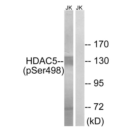 Western Blot - Anti-HDAC5 (phospho Ser498) Antibody (A7101) - Antibodies.com