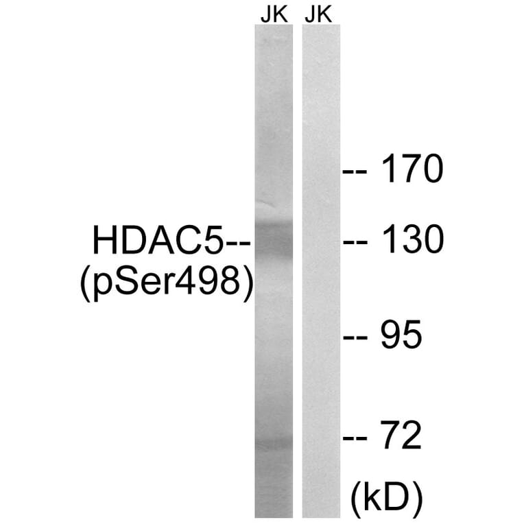 Western Blot - Anti-HDAC5 (phospho Ser498) Antibody (A7101) - Antibodies.com