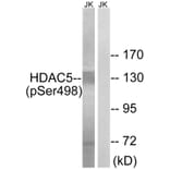 Western Blot - Anti-HDAC5 (phospho Ser498) Antibody (A7101) - Antibodies.com