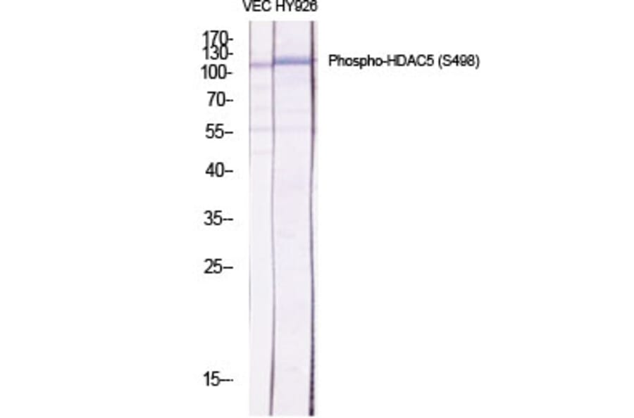 Western Blot - Anti-HDAC5 (phospho Ser498) Antibody (A7101) - Antibodies.com