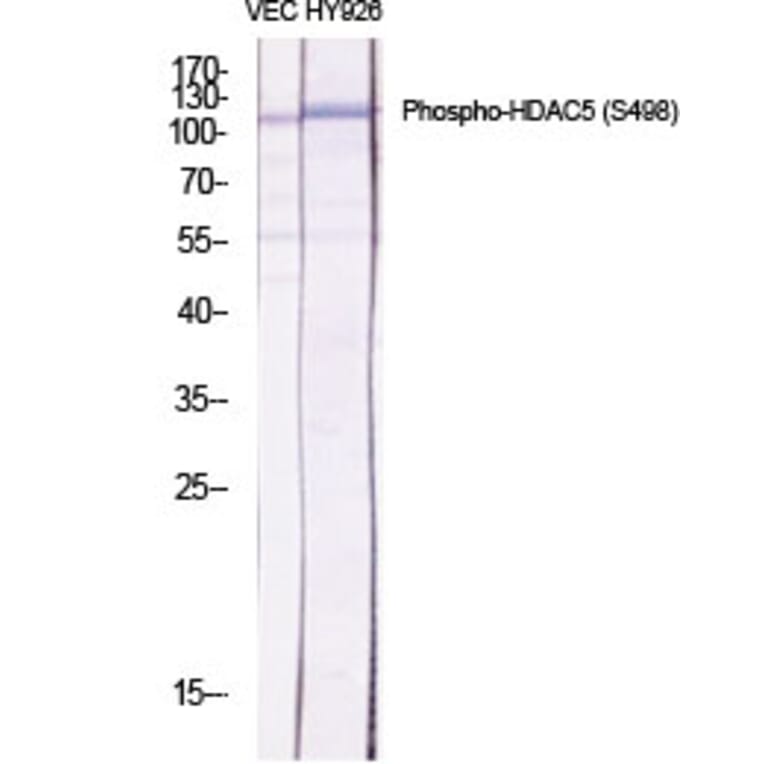 Western Blot - Anti-HDAC5 (phospho Ser498) Antibody (A7101) - Antibodies.com