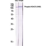 Western Blot - Anti-HDAC5 (phospho Ser498) Antibody (A7101) - Antibodies.com