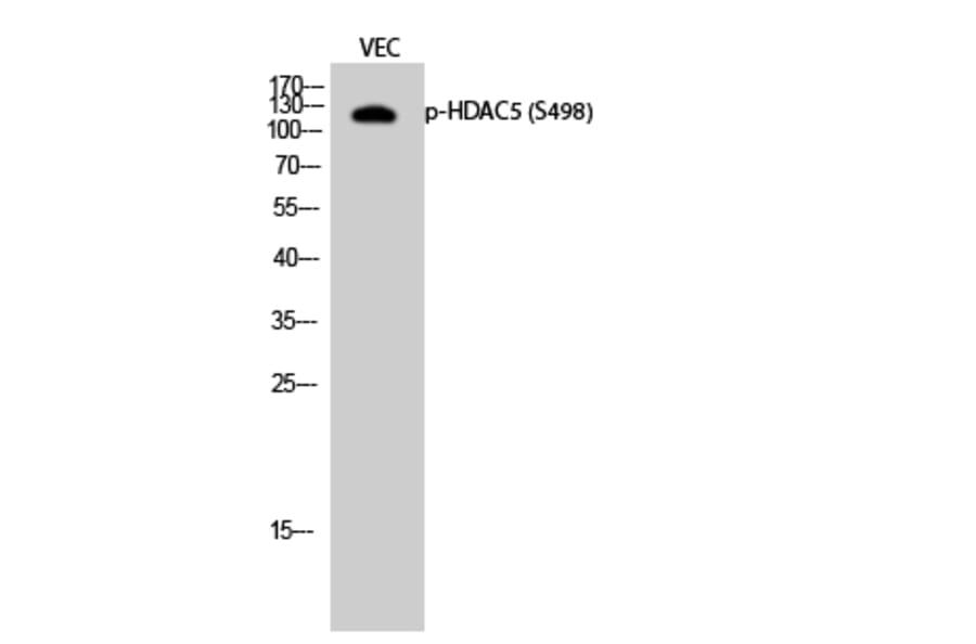 Western Blot - Anti-HDAC5 (phospho Ser498) Antibody (A7101) - Antibodies.com