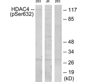 Western Blot - Anti-HDAC4 (phospho Ser632) Antibody (A7100) - Antibodies.com