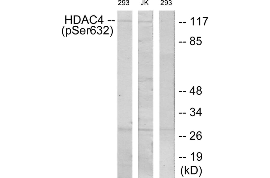 Western Blot - Anti-HDAC4 (phospho Ser632) Antibody (A7100) - Antibodies.com