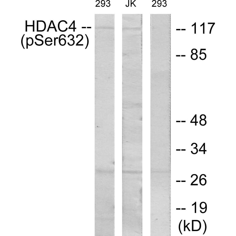 Western Blot - Anti-HDAC4 (phospho Ser632) Antibody (A7100) - Antibodies.com