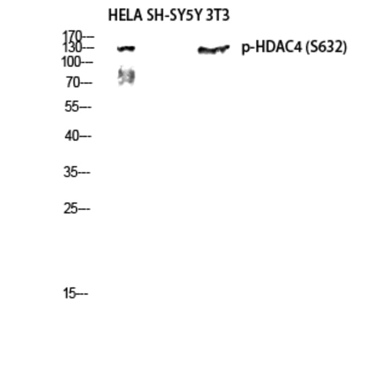 Western Blot - Anti-HDAC4 (phospho Ser632) Antibody (A7100) - Antibodies.com