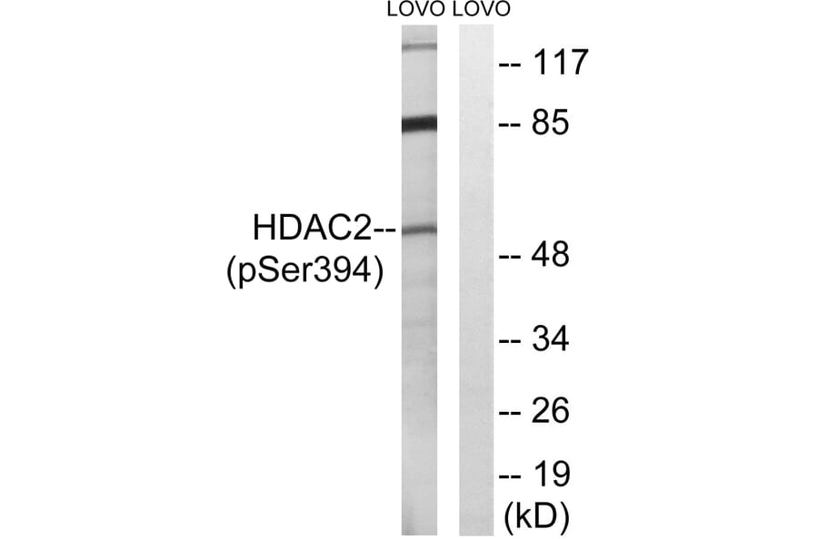 Western Blot - Anti-HDAC2 (phospho Ser394) Antibody (A7099) - Antibodies.com