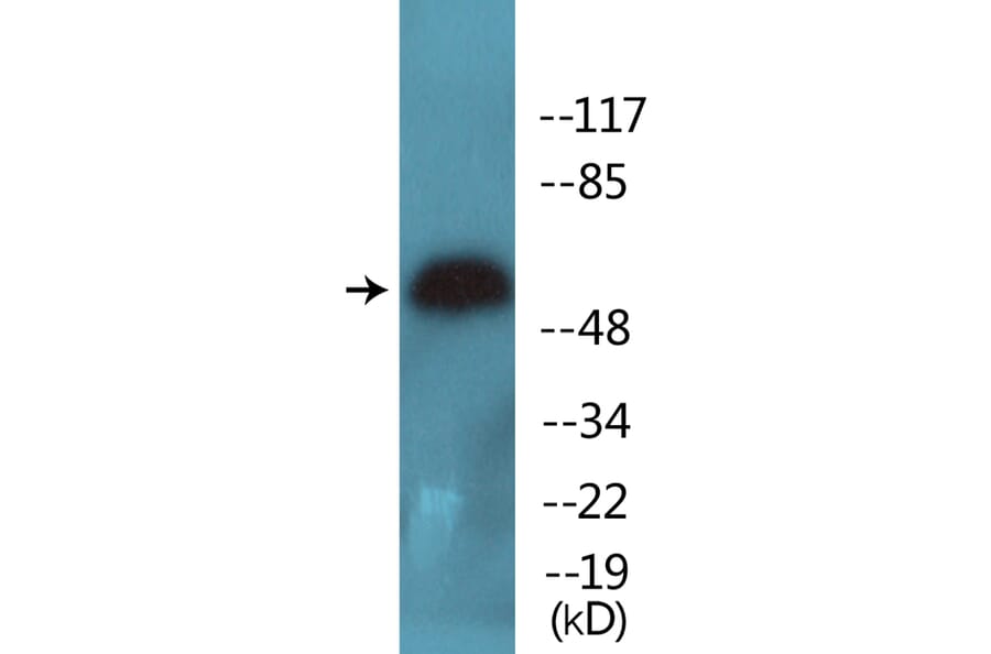 Western Blot - Anti-HDAC2 (phospho Ser394) Antibody (P12-1113) - Antibodies.com