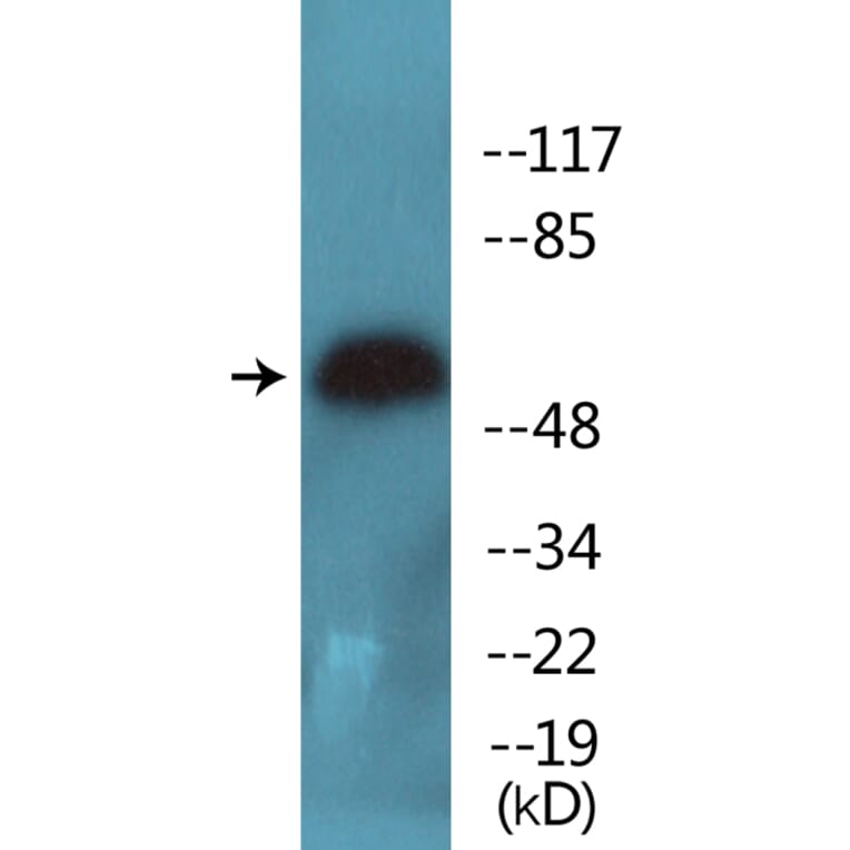 Western Blot - Anti-HDAC2 (phospho Ser394) Antibody (P12-1113) - Antibodies.com