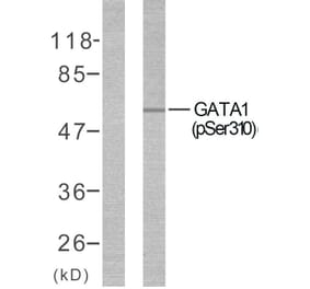 Western Blot - Anti-GATA1 (phospho Ser310) Antibody (A7093) - Antibodies.com