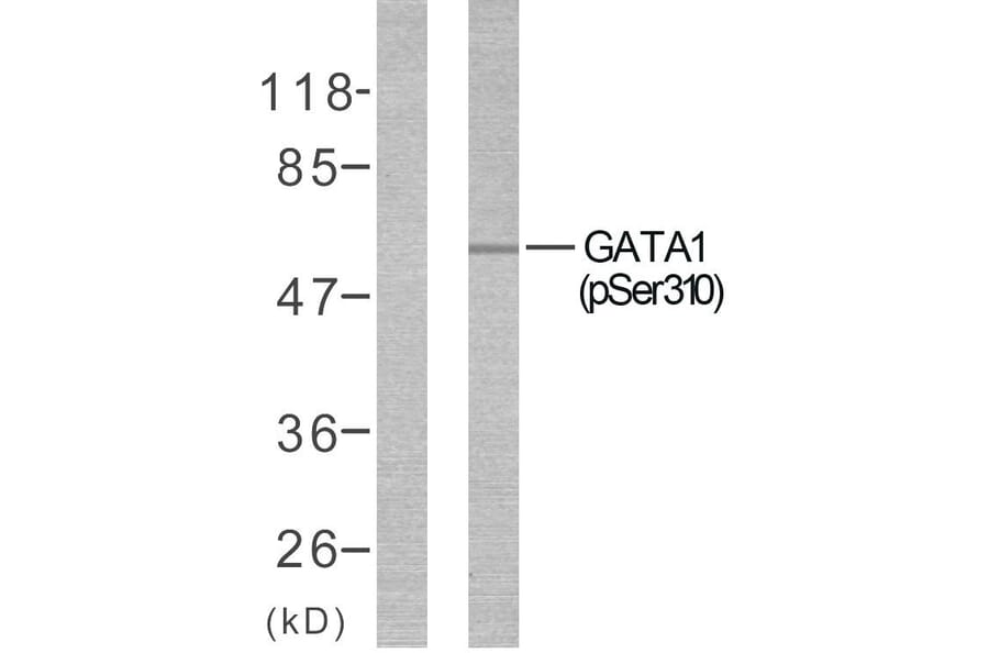 Western Blot - Anti-GATA1 (phospho Ser310) Antibody (A7093) - Antibodies.com