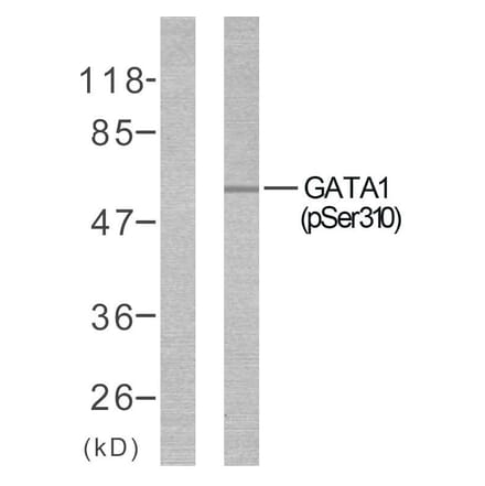 Western Blot - Anti-GATA1 (phospho Ser310) Antibody (A7093) - Antibodies.com