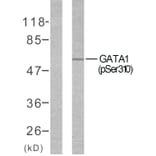 Western Blot - Anti-GATA1 (phospho Ser310) Antibody (A7093) - Antibodies.com