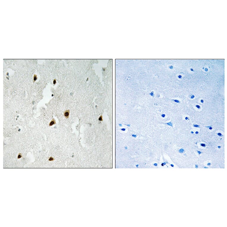 Immunohistochemistry - Anti-FOXO4 (phospho Ser262) Antibody (A8037) - Antibodies.com