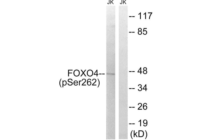 Western Blot - Anti-FOXO4 (phospho Ser262) Antibody (A8037) - Antibodies.com