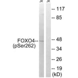 Western Blot - Anti-FOXO4 (phospho Ser262) Antibody (A8037) - Antibodies.com