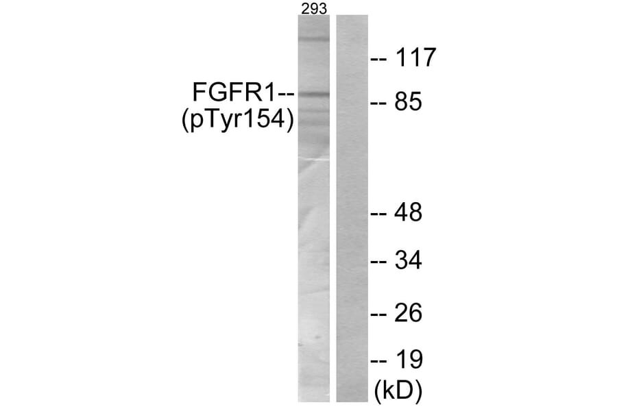 Western Blot - Anti-FGFR1 (phospho Tyr154) Antibody (A7084) - Antibodies.com