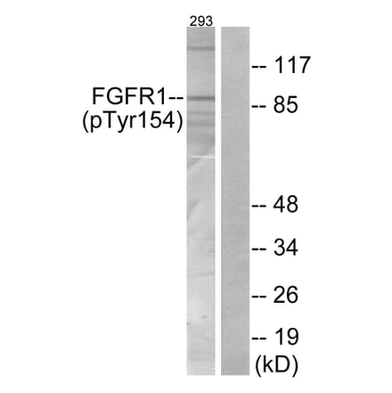 Western Blot - Anti-FGFR1 (phospho Tyr154) Antibody (A7084) - Antibodies.com