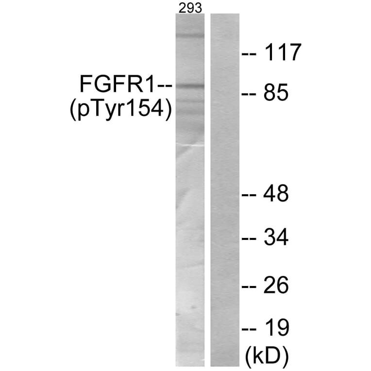 Western Blot - Anti-FGFR1 (phospho Tyr154) Antibody (A7084) - Antibodies.com