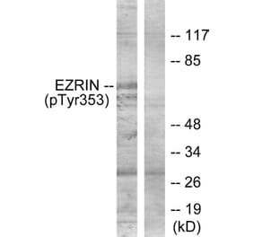 Western Blot - Anti-Ezrin (phospho Tyr353) Antibody (A7080) - Antibodies.com