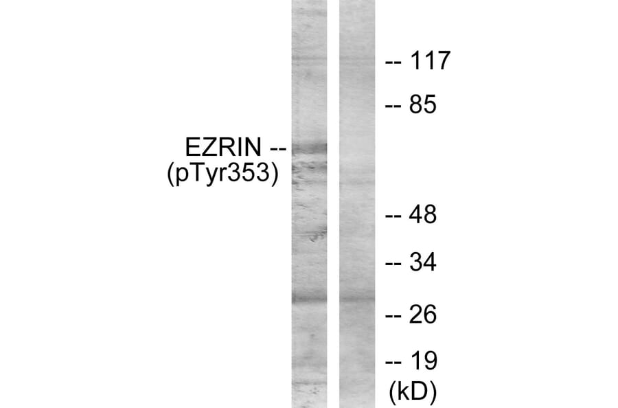 Western Blot - Anti-Ezrin (phospho Tyr353) Antibody (A7080) - Antibodies.com