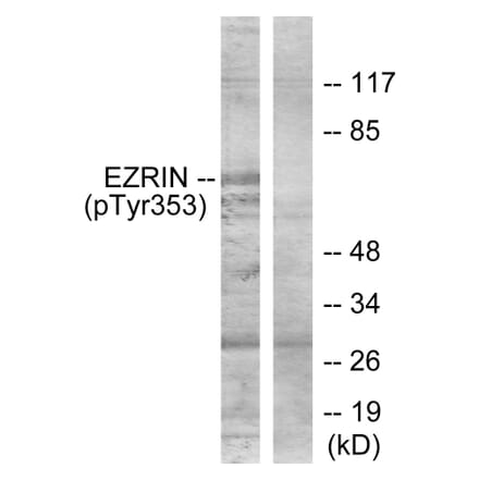 Western Blot - Anti-Ezrin (phospho Tyr353) Antibody (A7080) - Antibodies.com