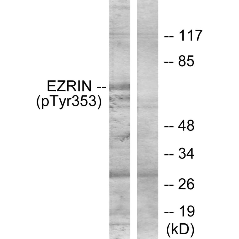 Western Blot - Anti-Ezrin (phospho Tyr353) Antibody (A7080) - Antibodies.com