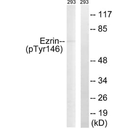 Western Blot - Anti-Ezrin (phospho Tyr146) Antibody (A8030) - Antibodies.com