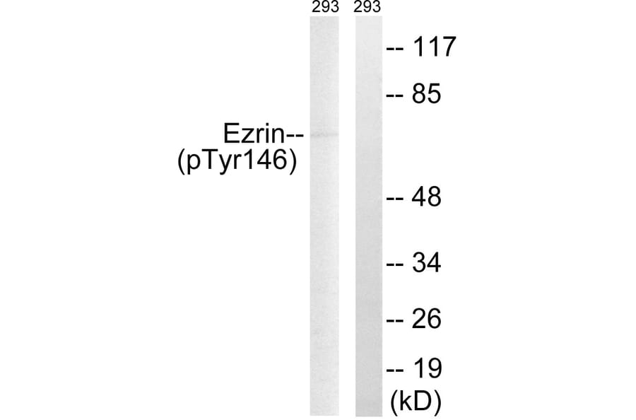 Western Blot - Anti-Ezrin (phospho Tyr146) Antibody (A8030) - Antibodies.com