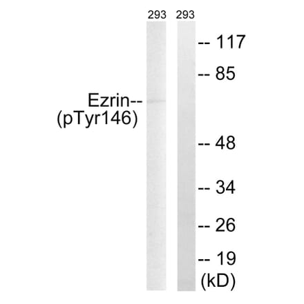 Western Blot - Anti-Ezrin (phospho Tyr146) Antibody (A8030) - Antibodies.com