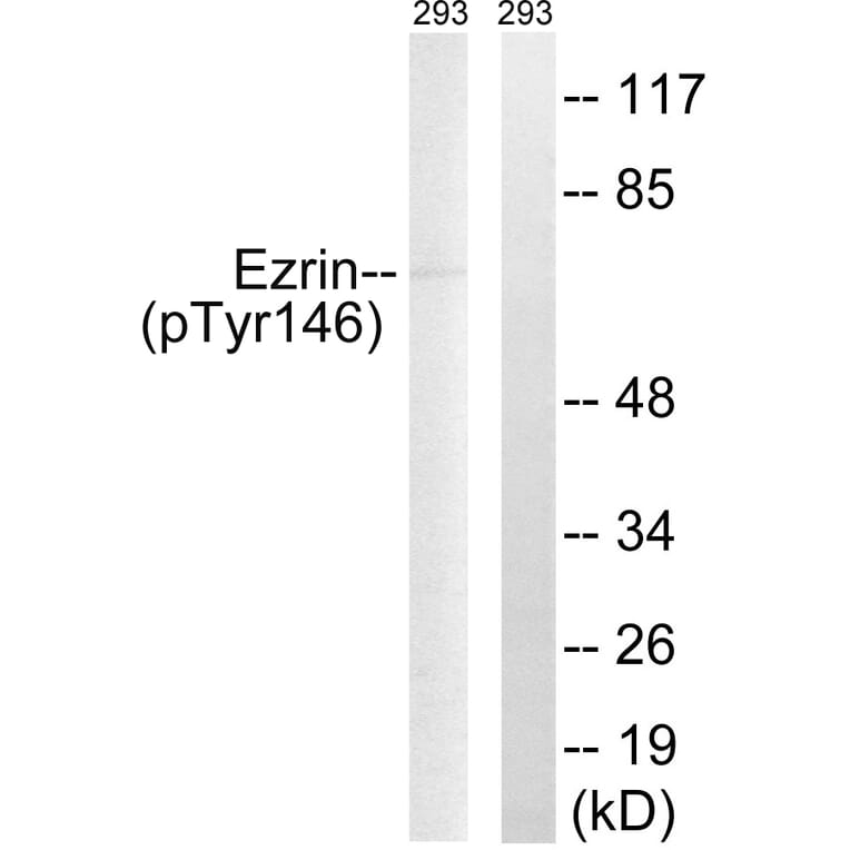 Western Blot - Anti-Ezrin (phospho Tyr146) Antibody (A8030) - Antibodies.com