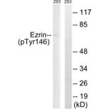 Western Blot - Anti-Ezrin (phospho Tyr146) Antibody (A8030) - Antibodies.com