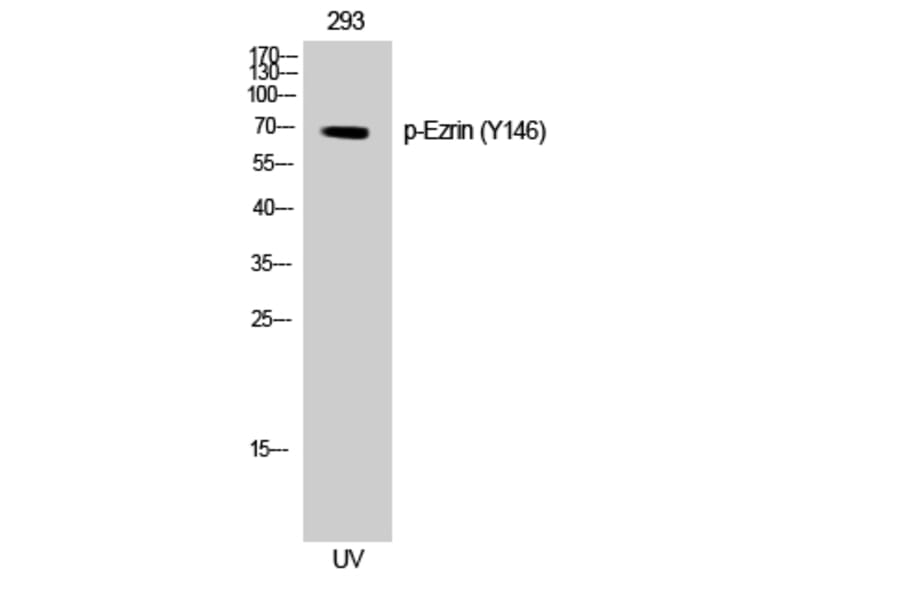 Western Blot - Anti-Ezrin (phospho Tyr146) Antibody (A8030) - Antibodies.com