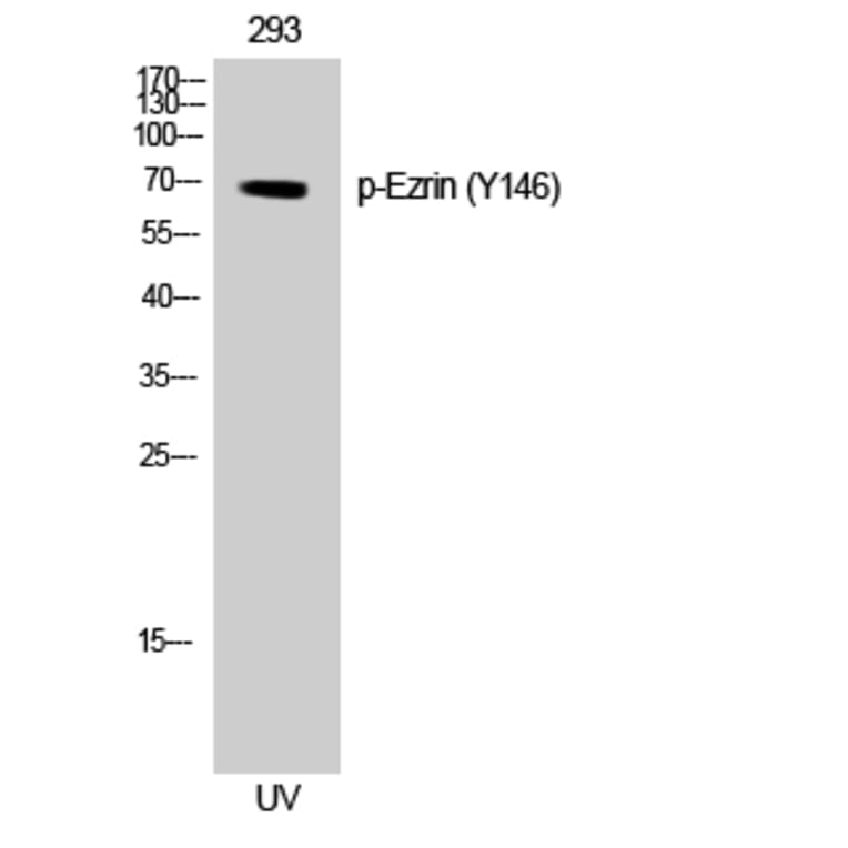 Western Blot - Anti-Ezrin (phospho Tyr146) Antibody (A8030) - Antibodies.com