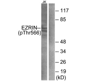 Western Blot - Anti-Ezrin (phospho Thr566) Antibody (A7079) - Antibodies.com