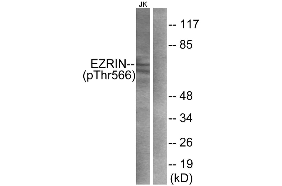 Western Blot - Anti-Ezrin (phospho Thr566) Antibody (A7079) - Antibodies.com