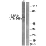 Western Blot - Anti-Ezrin (phospho Thr566) Antibody (A7079) - Antibodies.com
