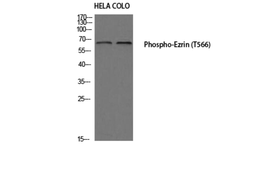 Western Blot - Anti-Ezrin (phospho Thr566) Antibody (A7079) - Antibodies.com