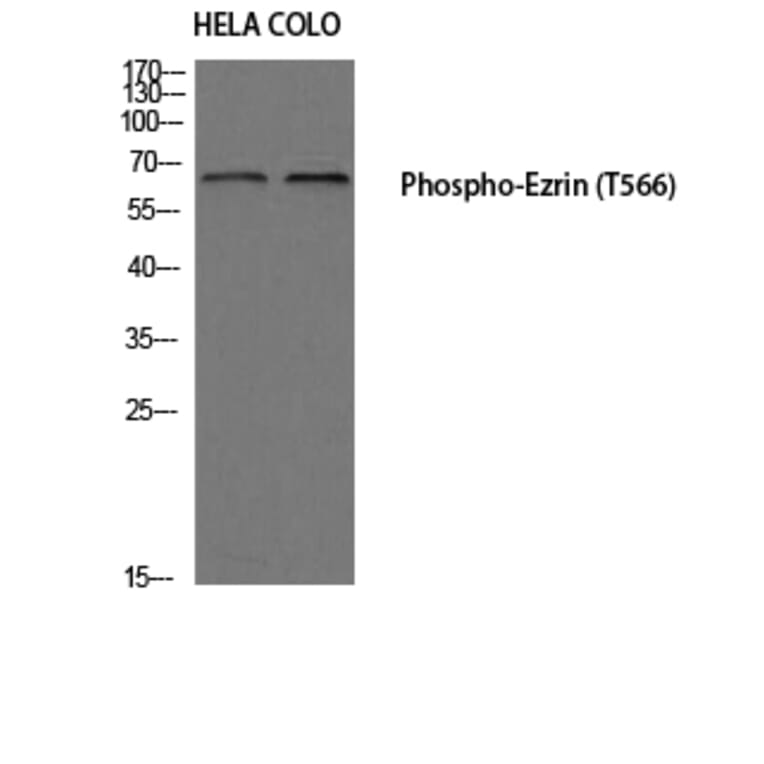 Western Blot - Anti-Ezrin (phospho Thr566) Antibody (A7079) - Antibodies.com