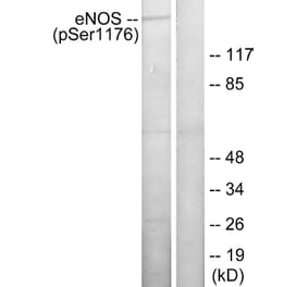 Western Blot - Anti-eNOS (phospho Ser1176) Antibody (A7071) - Antibodies.com