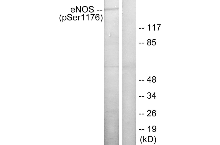 Western Blot - Anti-eNOS (phospho Ser1176) Antibody (A7071) - Antibodies.com