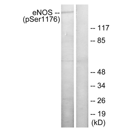 Western Blot - Anti-eNOS (phospho Ser1176) Antibody (A7071) - Antibodies.com