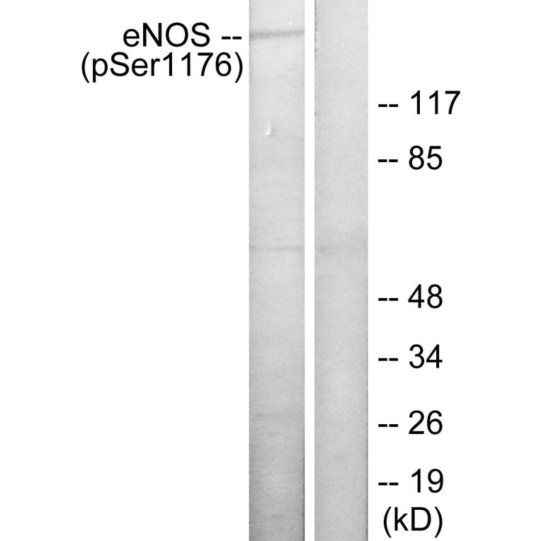 Western Blot - Anti-eNOS (phospho Ser1176) Antibody (A7071) - Antibodies.com